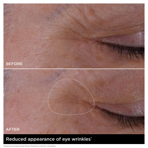 Double Serum Eye - Traitement Yeux Jeunesse Intensif